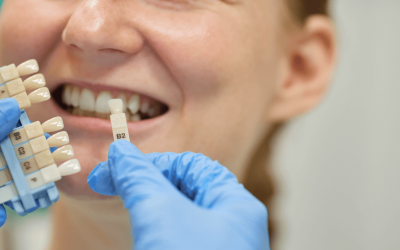 Top 5 Benefits of Full Mouth Dental Implants: The Ultimate Solution for Missing Teeth